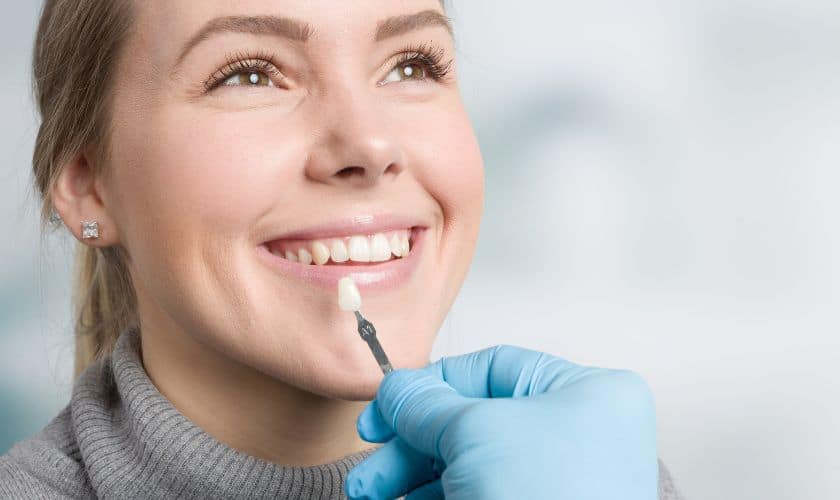 advantages of dental veneers