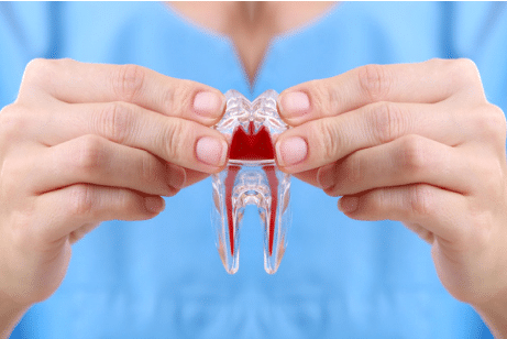 endodontics in Prosper